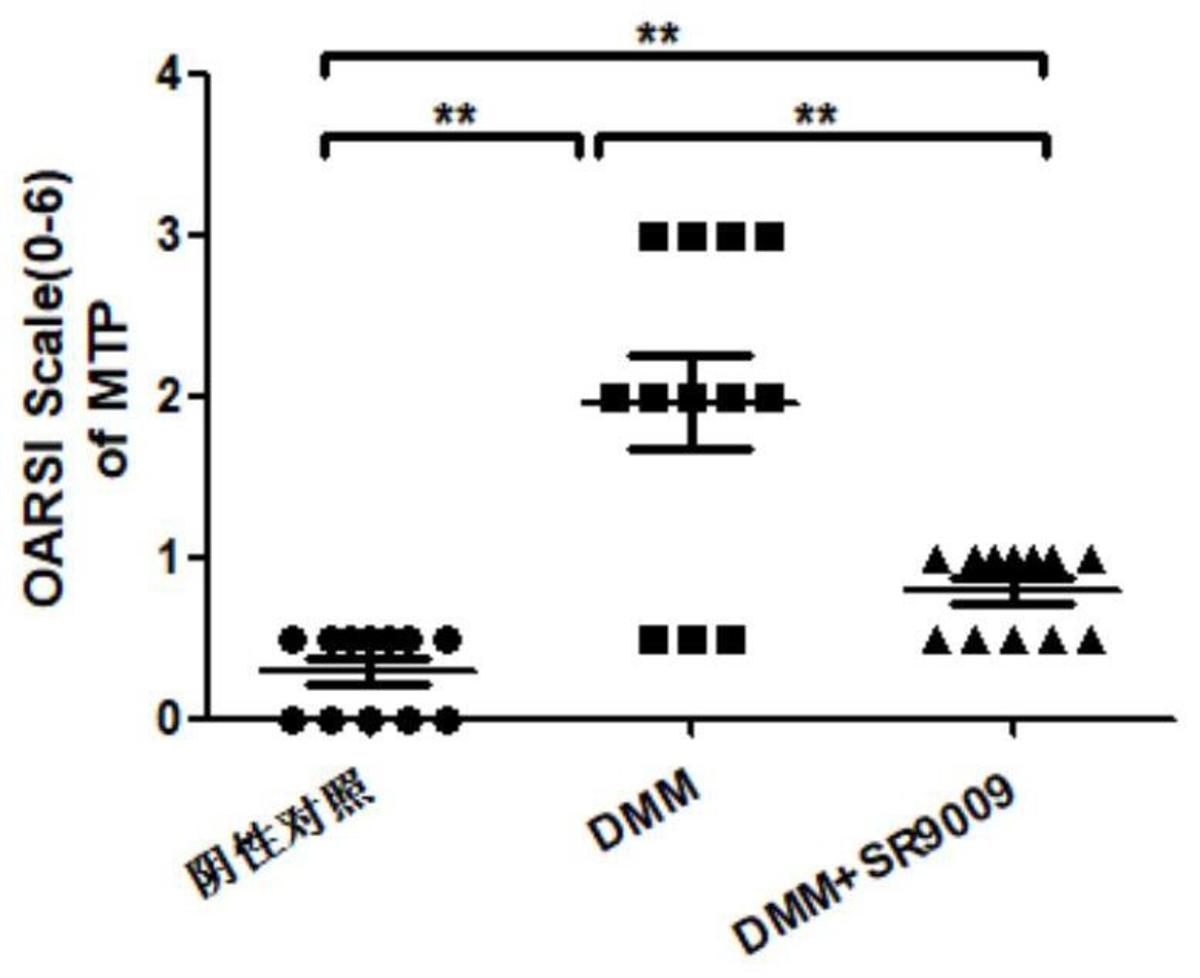 一種NR1D1激動(dòng)劑SR9009脂質(zhì)體及其在治療骨性關(guān)節(jié)炎藥物中的應(yīng)用