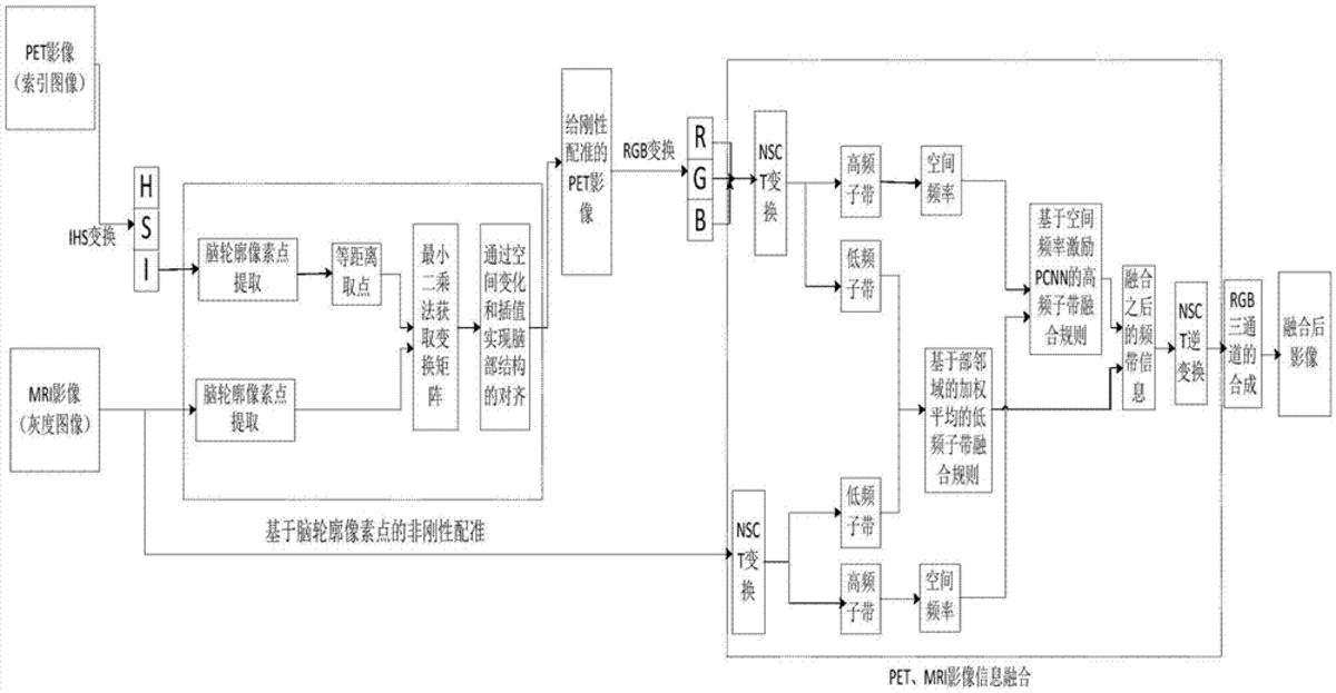 一種改進(jìn)神經(jīng)網(wǎng)絡(luò)的PET/MRI異機(jī)腦部影像信息融合方法