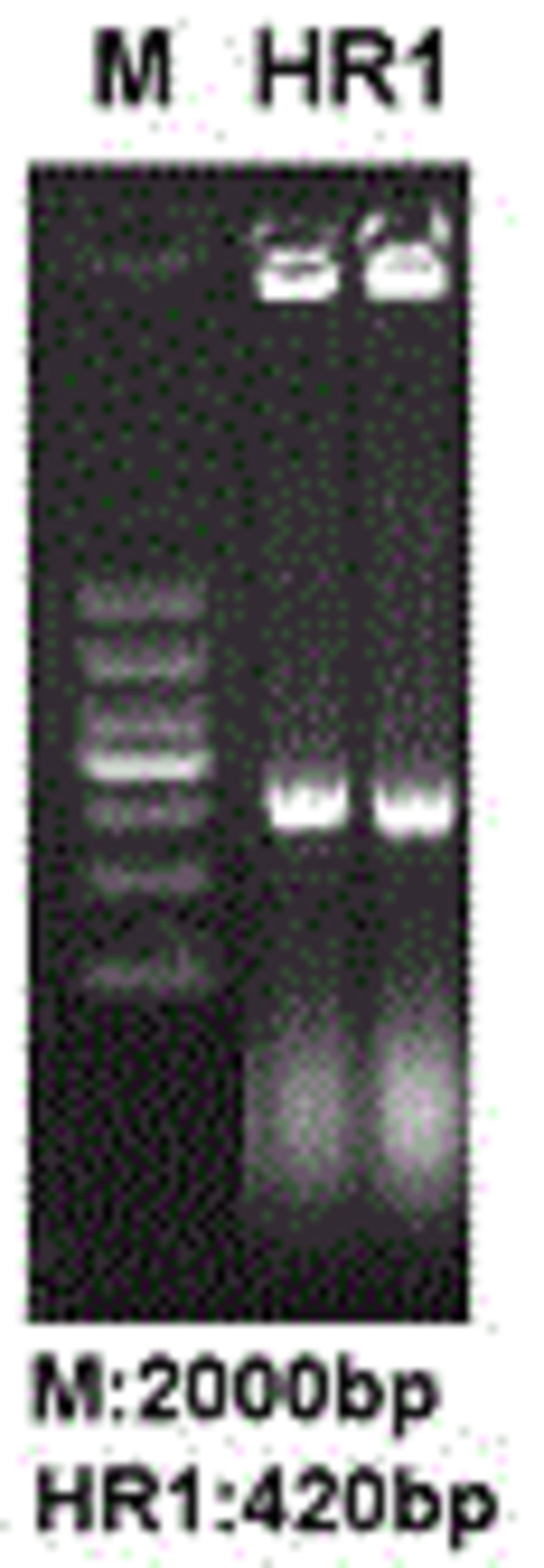 一種長(zhǎng)鏈非編碼RNA lnc?HR1用途及克隆方法