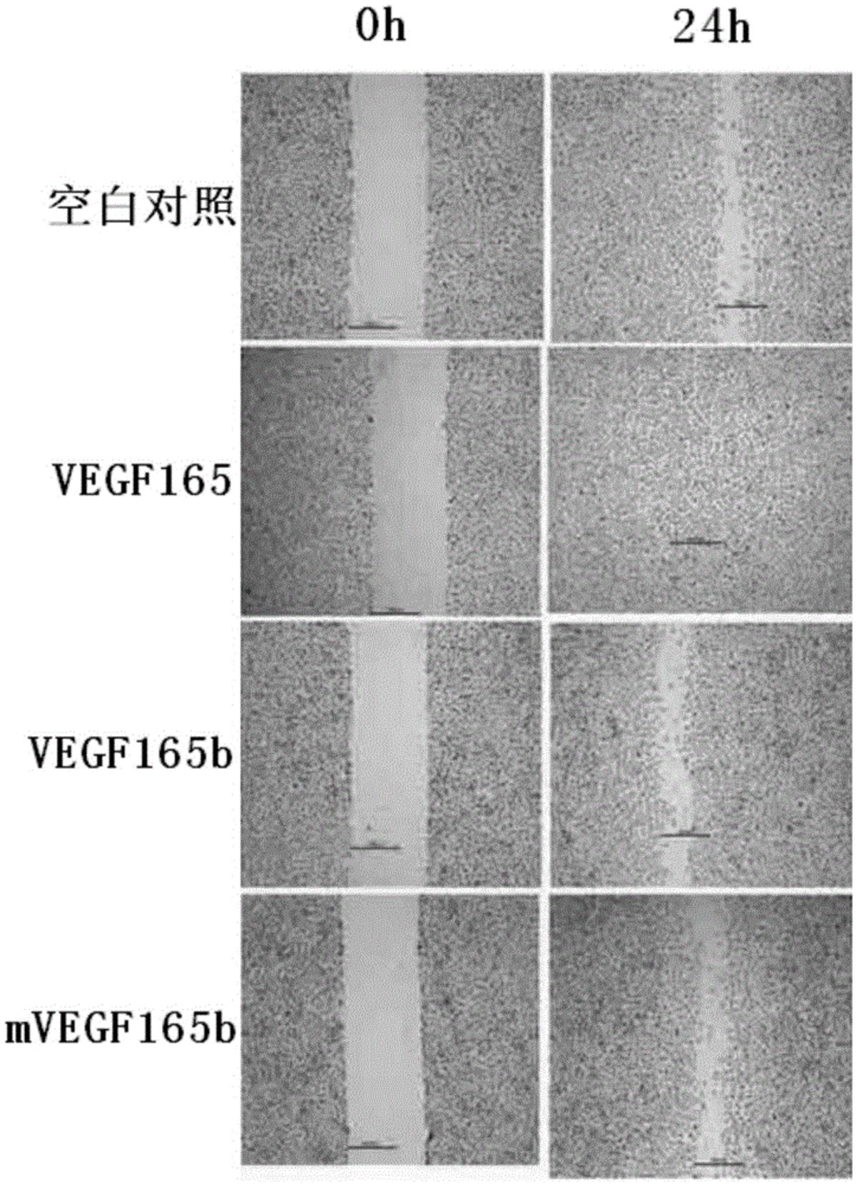 VEGF165b突變體及其制備方法和應(yīng)用